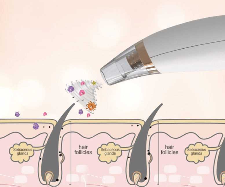 Powerful Electric Blackhead Remover for Home Use by Dealightful Finds